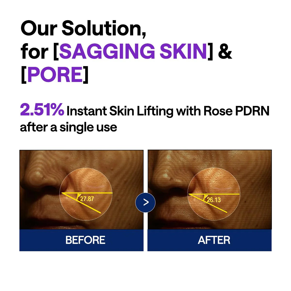 Mediheal PDRN Lifting Serum | Wholesale K-Beauty
