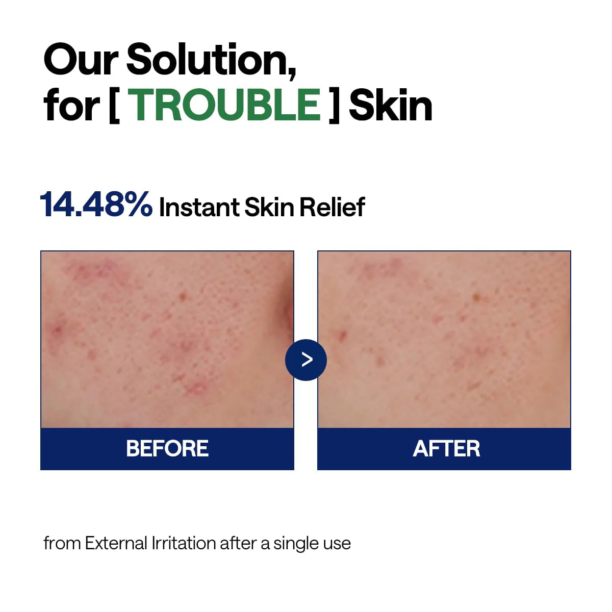 Mediheal Teatree Calming Hydra Serum | Wholesale K-Beauty