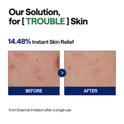 Mediheal Teatree Calming Hydra Serum | Wholesale K-Beauty