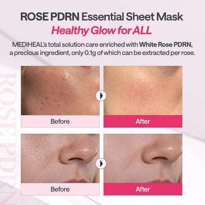 Mediheal Rose PDRN Essential Sheet Mask– 99% Pure White Rose PDRN & Hyaluronic Acid for hydrating – Wholesale K-Beauty (Pack of 10)