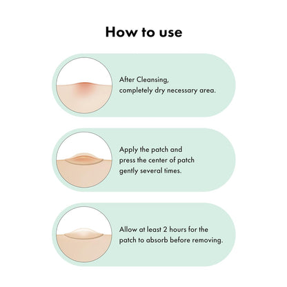 TGI PATCH Microcone Trouble Spot - Patches for Early Stage of Skin Trouble - Invisible (6pc) | Wholsale K-Beauty