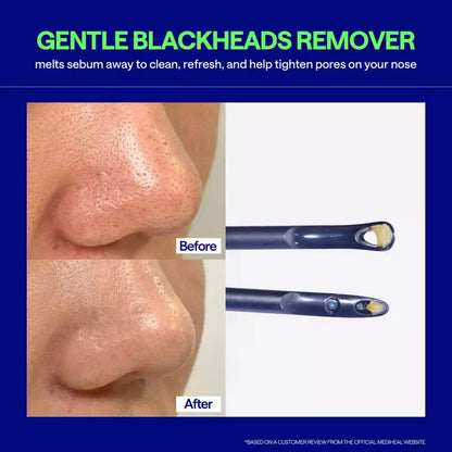 Mediheal Blackhead Melting Clear Nose Patch (Pack of 4) - 3 Step Blackhead Care Kit, Tool Included | Wholesale K-Beauty