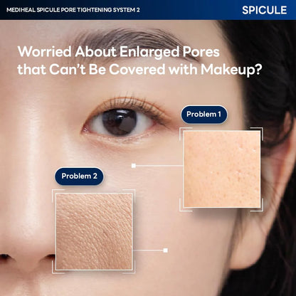 Close-up of enlarged pore concerns targeted by Mediheal Spicule System 2